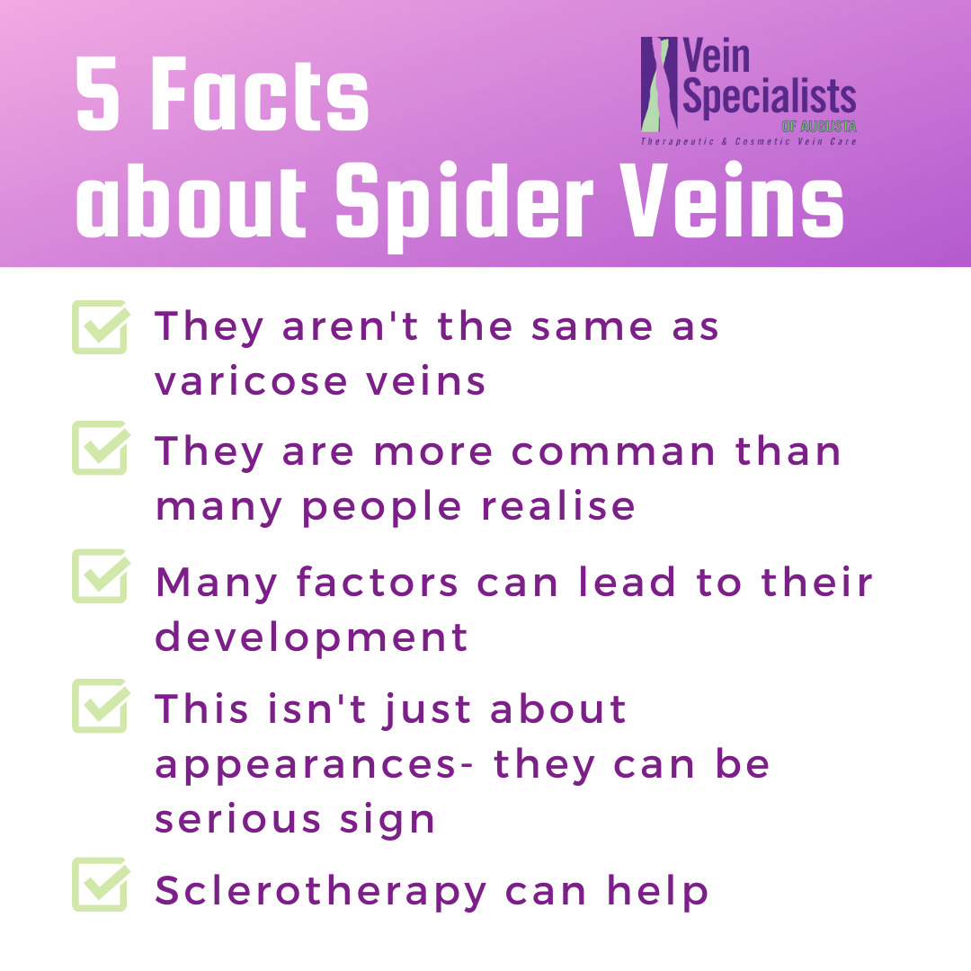 5 facts about Spider Veins- Vein Consultation at Vein Specialist of Augusta