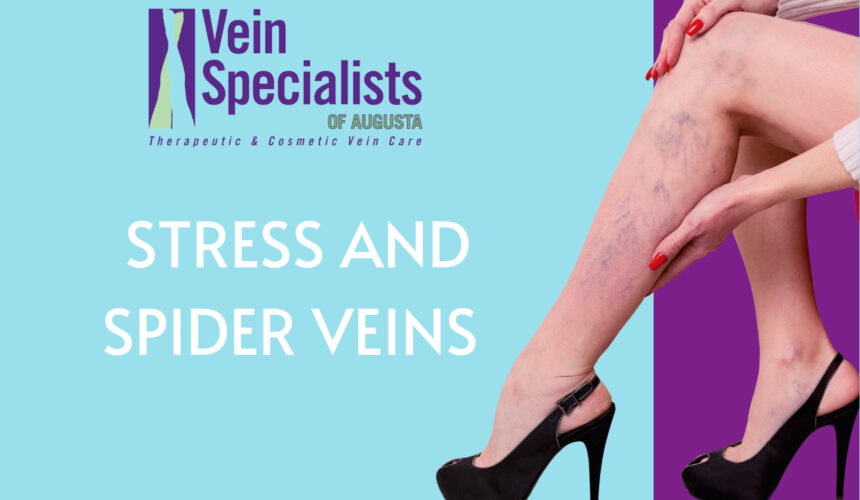 Stress and Spider Veins- Vein Specialists of Augusta
