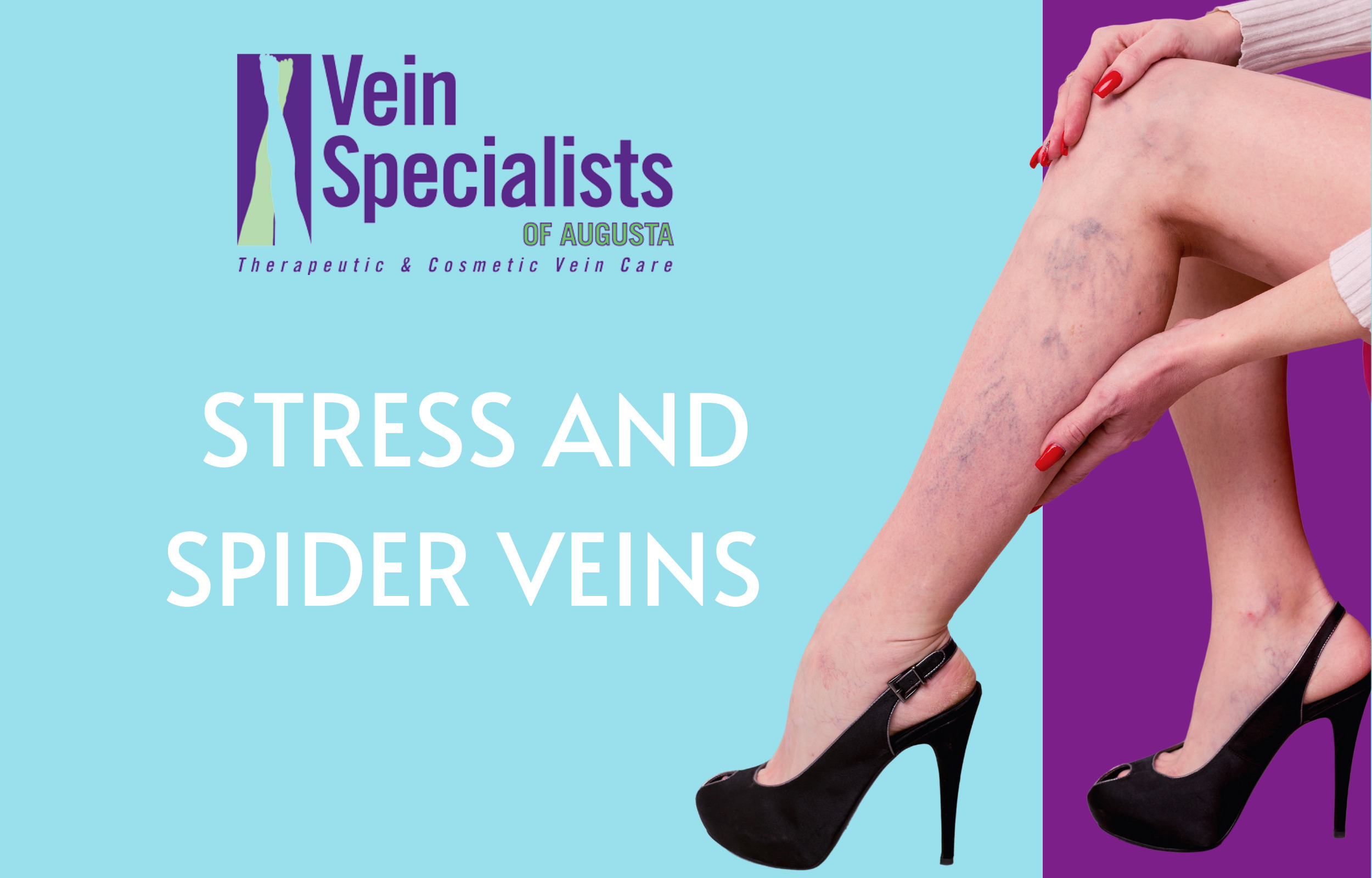 Can Stress Cause Spider Veins On Legs? - Vein Specialists of Augusta