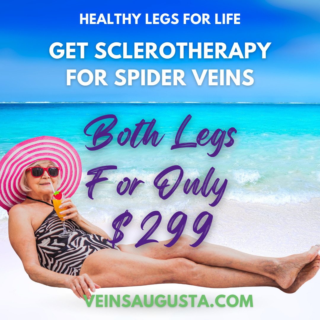 Sclerotherapy specials for May and June of 2022