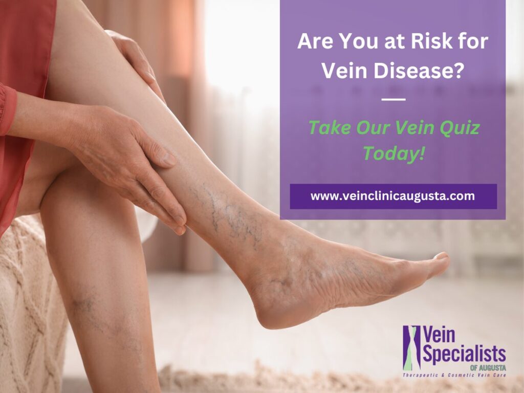 Vein Quiz at Vein Specialist of Augusta