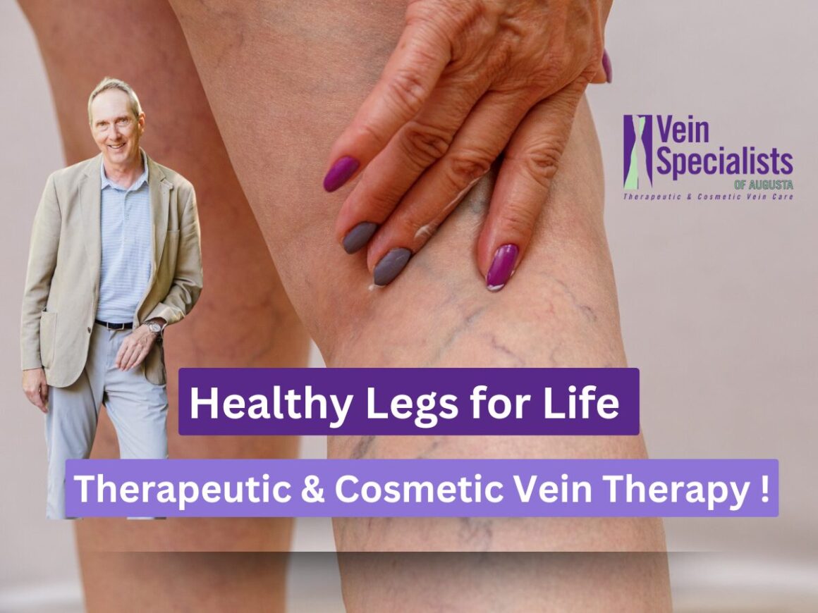 Therapeutic and Cosmetic Vein Therapy- Healthy legs for life at Vein Specialists of Augusta