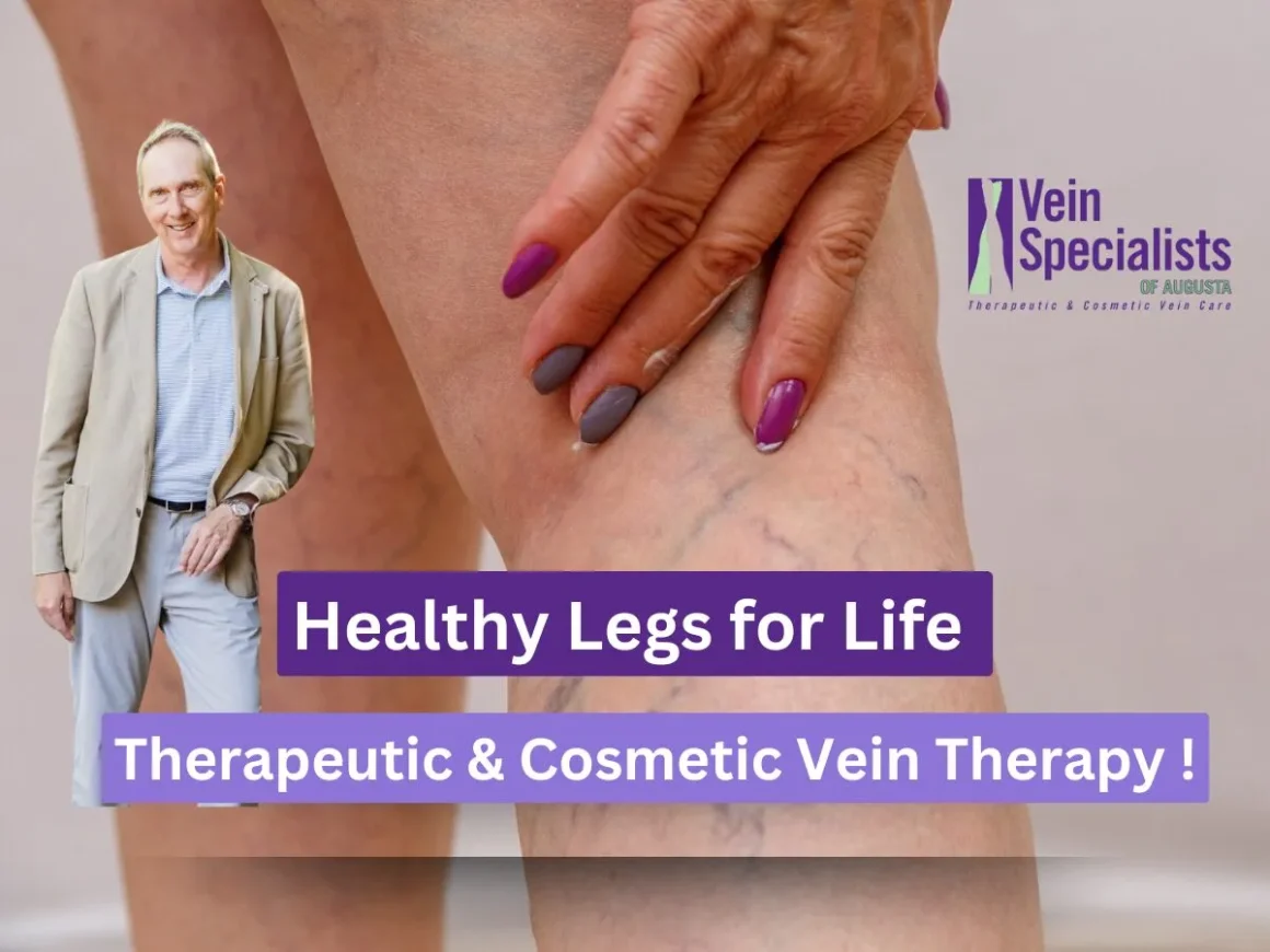 Healthy Legs for Life: Therapeutic and Cosmetic Vein Therapy at Vein Specialists of Augusta