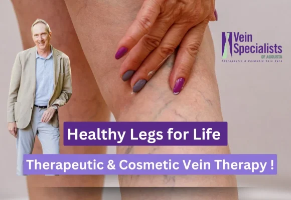 Vein-Specialists-of-Augusta-Tired-of-Painful-Aching-Veins-Relief-is-Closer-Than-You-Think-2 Healthy Legs for Life: Therapeutic and Cosmetic Vein Therapy at Vein Specialists of Augusta